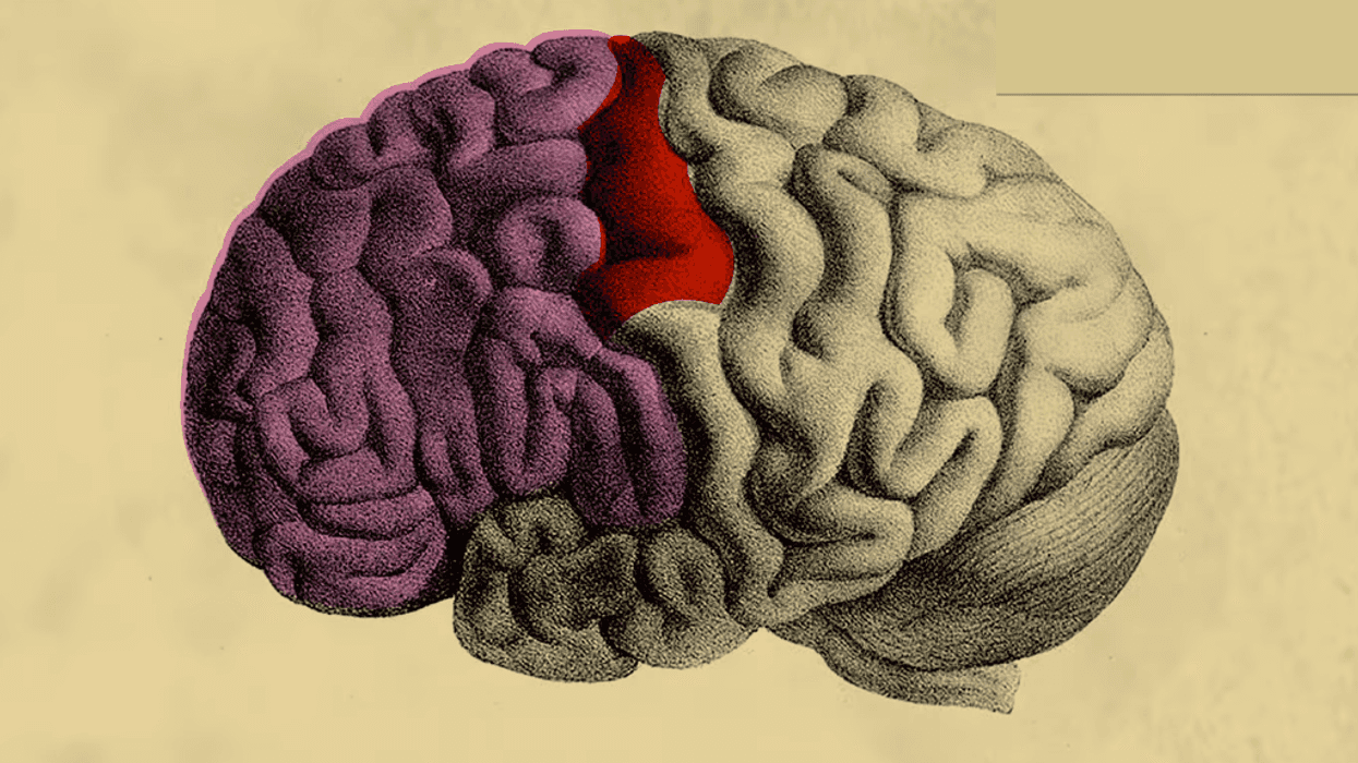 Brain_0