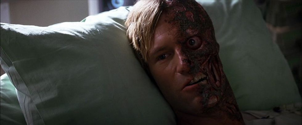 Harvey Dent at the hospital after Joker's attack.