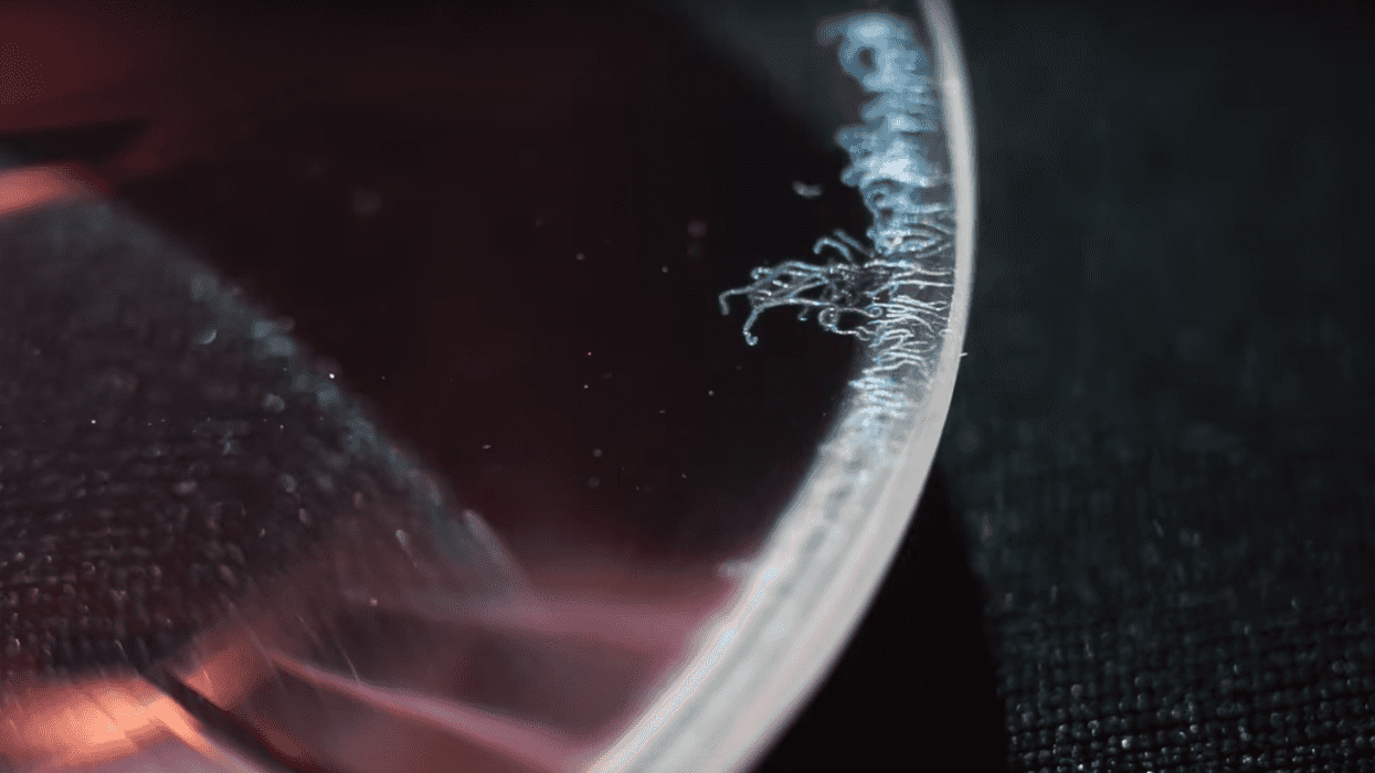 How to Remove Fungus from a Lens (by Mathieu Stern)