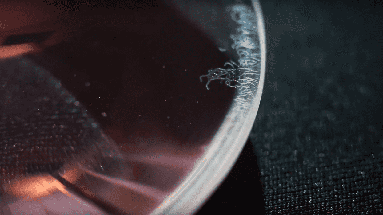 Lens_fungus