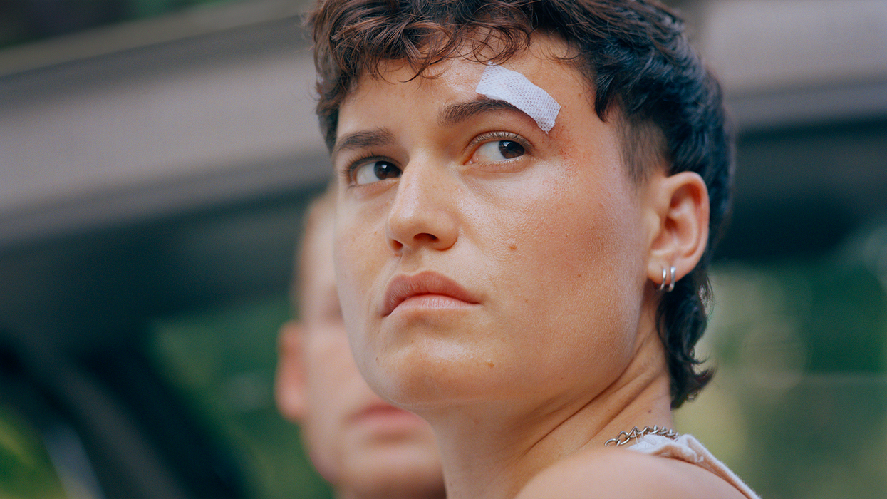 Lío Mehiel as Feña with a bandage on their eyebrow in 'Mutt'