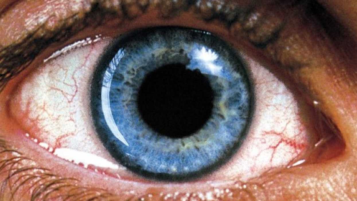 requiem for a dream editing no film school video essay aranofsky
