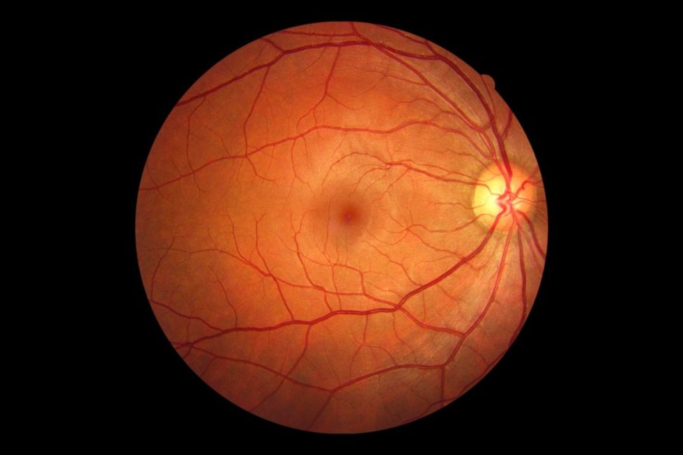 The Human Retina